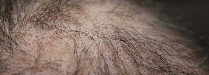 Use alecrim para acabar com os problemas de quedas de cabelo