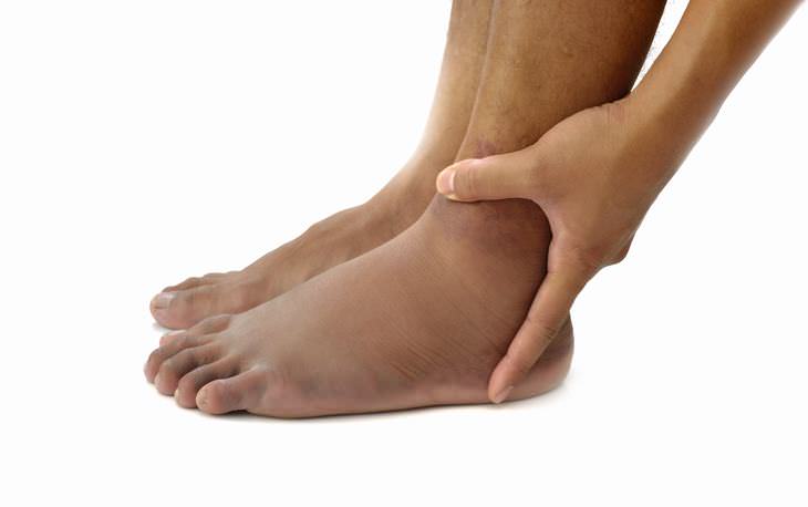 4 Métodos naturais para tratar pés inchados e pernas