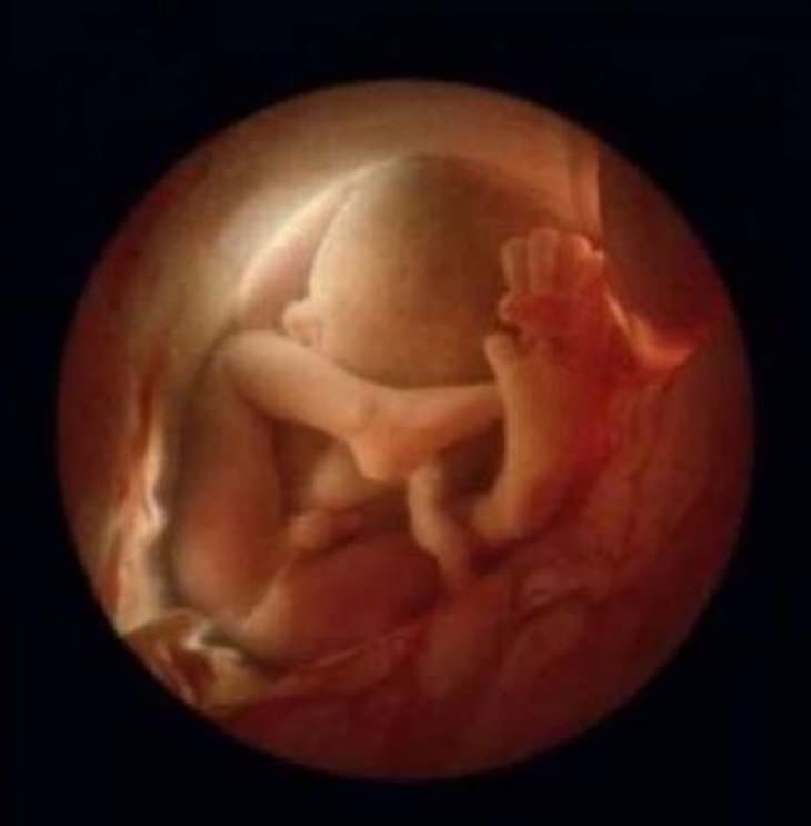 fotógrafo capta imagens de bebê ainda no útero