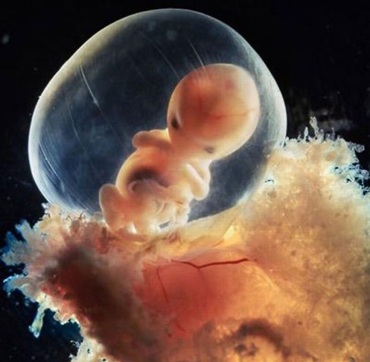 fotógrafo capta imagens de bebê ainda no útero