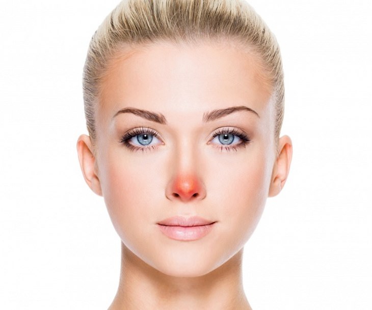 Saúde da pele: Veja 10 possíveis causas de manchas no rosto