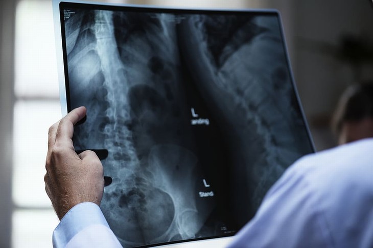 15 Perguntas para o médico radiografia dos ossos