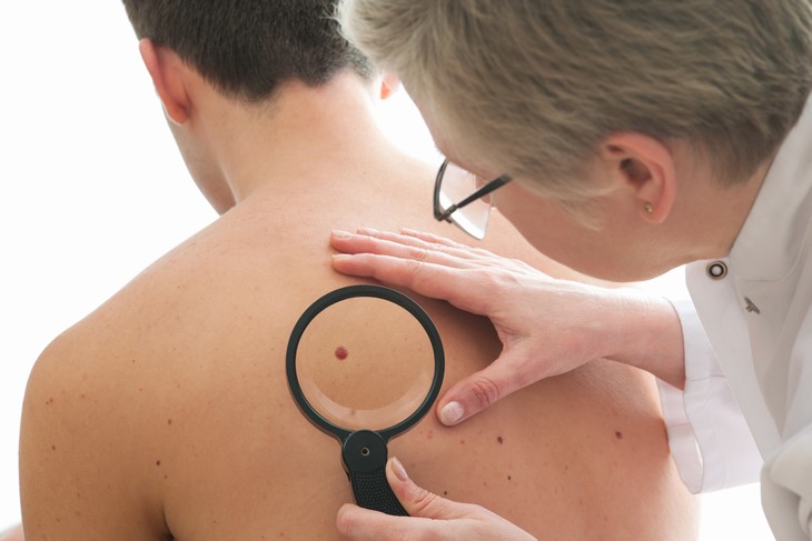 15 Perguntas para o médico exame de sinais da pele