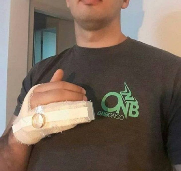 Hilarious but Smart Life Hacks, man with broken ring finger in a cast and bandages, with wedding ring taped to his ring finger