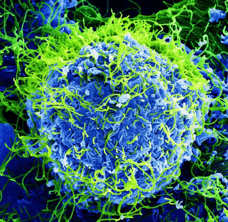 6 epidemias mortais da nossa história Ebola vírus