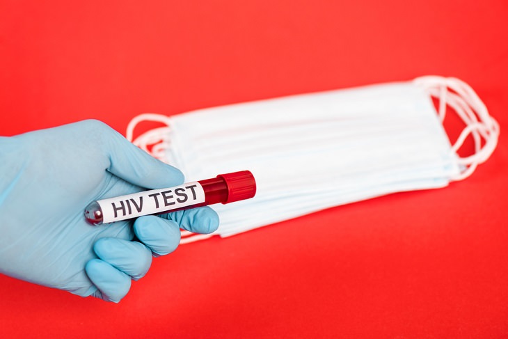 6 epidemias mortais da nossa história HIV-AIDS