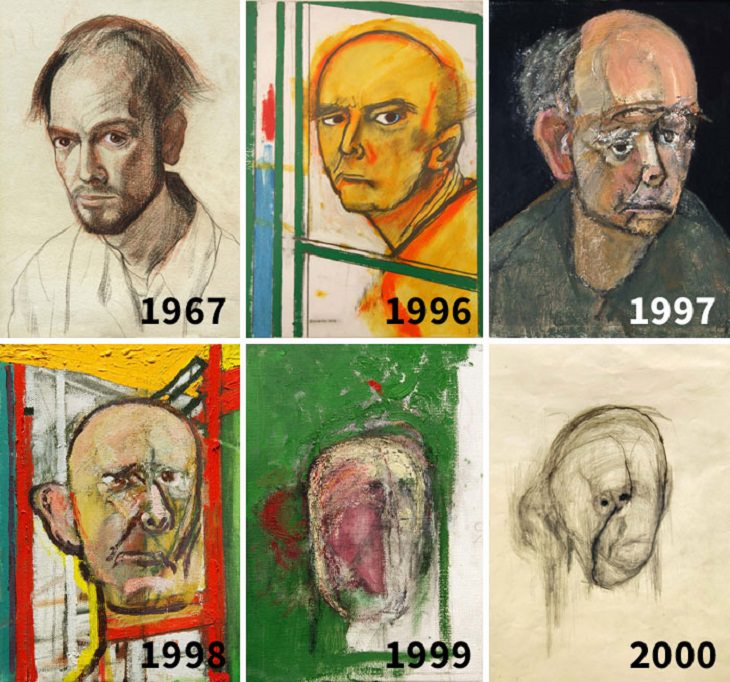 Comparações espantosas artista com Alzheimer