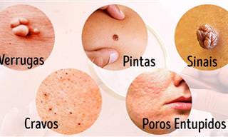 8 Doenças sérias sinalizadas pela nossa pele