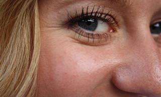 10 Remédios Naturais Para Acabar Com Rugas em Torno Dos Olhos