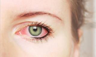 O Que Seus Olhos Dizem Sobre Sua Saúde?