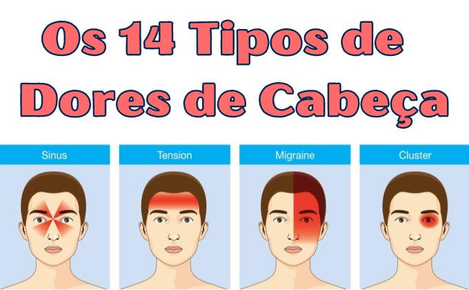 Os 14 Tipos De Dores De Cabe a Mais Comuns Sa de TudoPorEmail